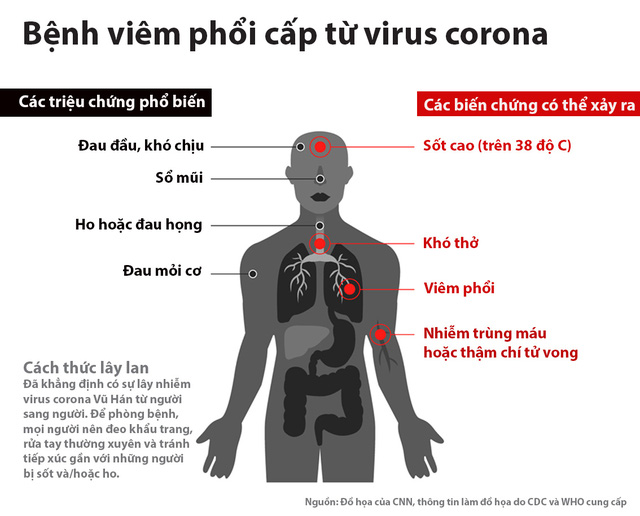 bệnh viêm phổi do virus corona